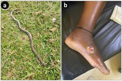 ចំនួនអ្នកស្លាប់ច្រើនជាងធ្វើសង្គ្រាមទៅទៀត! មនុស្សរាប់ម៉ឺននាក់នៅឥណ្ឌាបាត់បង់ជីវិតរៀងរាល់ឆ្នាំដោយសារសត្វកាចសាហាវមួយនេះ!